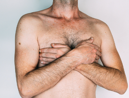 Unilateral Gynecomastia Correction